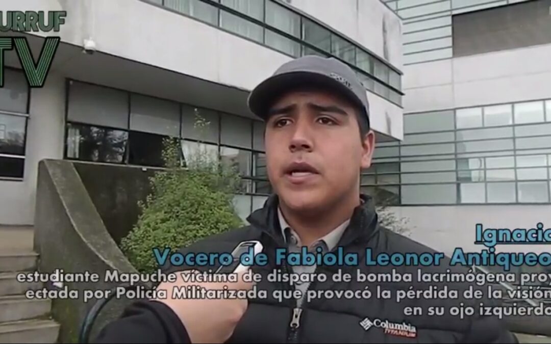 (Video Vocería) La Joven Fabiola Antiqueo Pierde Ojo Izquierdo tras Ataque a Quemarropa de Carabineros.