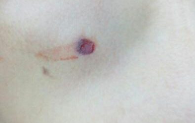 [Audio Reporte] Un herido por balín tras allanamiento en Trafun región de Los Ríos