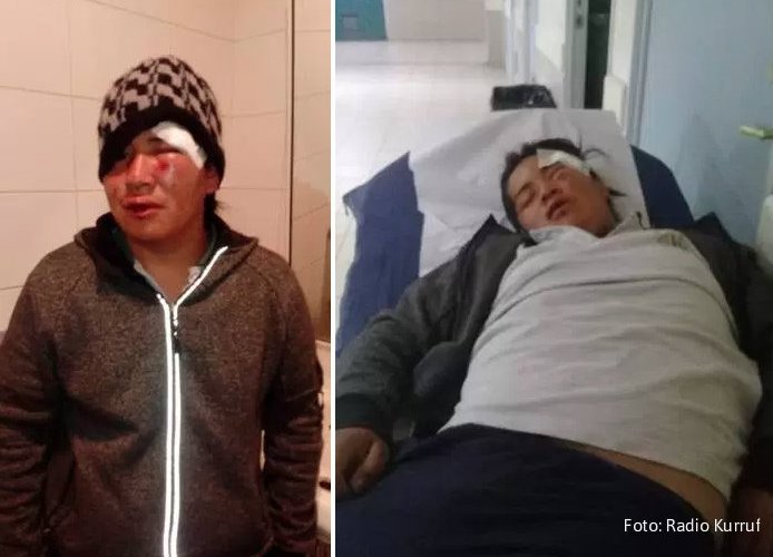 [Ercilla] Parceleros Golpean Brutalmente a Jóven Mapuche
